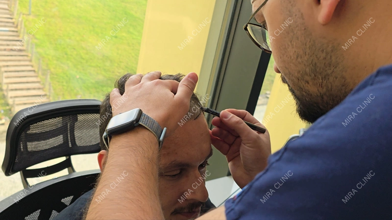 Doctor Consultation and Choosing the Right Technique